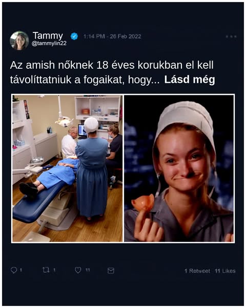 Miért népszerű a fogeltávolítás az amish nők körében