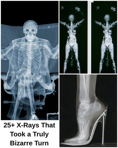 25+ Strange X-Rays That Had Everyone Doing a Double Take