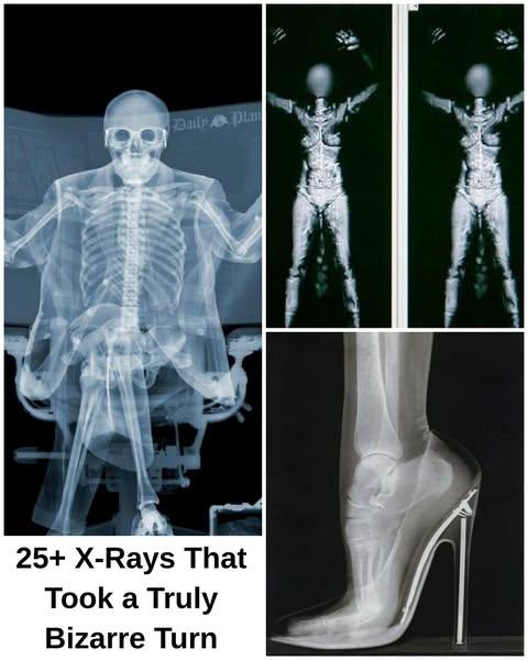 25+ Strange X-Rays That Had Everyone Doing a Double Take