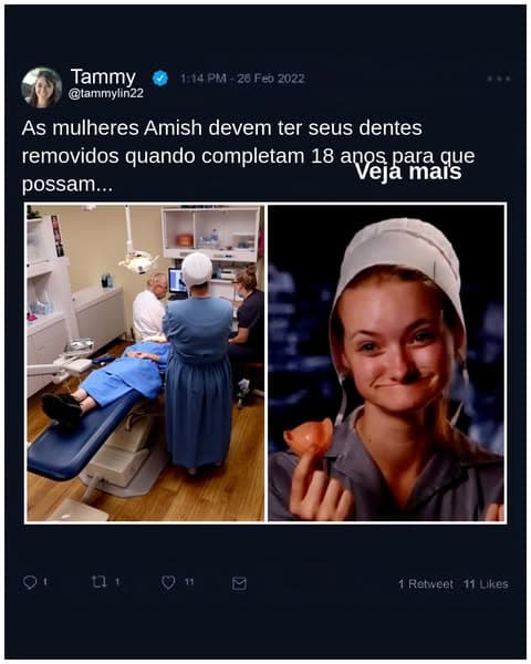 Por que a remoção de dentes é popular entre as mulheres Amish