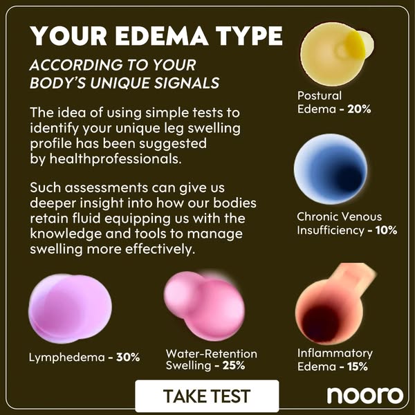 I took this 1-minute edema test…