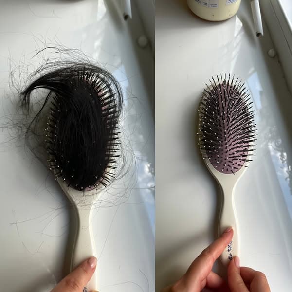 The Real Reason Your Hair Keeps Thinning—No One Talks About This Hormone