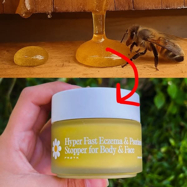 My psoriasis started fading before my eyes!