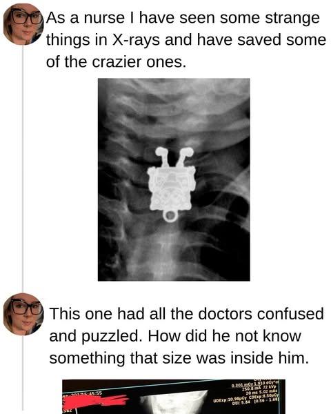 20+ X-Rays That Left Doctors Completely Baffled