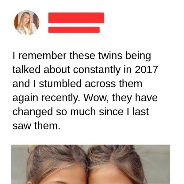 The Inspirational Story of These Beautiful Twins and Their Road to Modelling