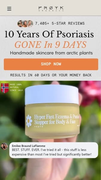 My psoriasis started fading before my eyes!