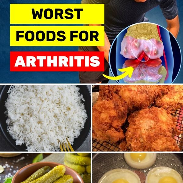 Doctor Confirms: People With Arthritis Should Cut Out These Foods