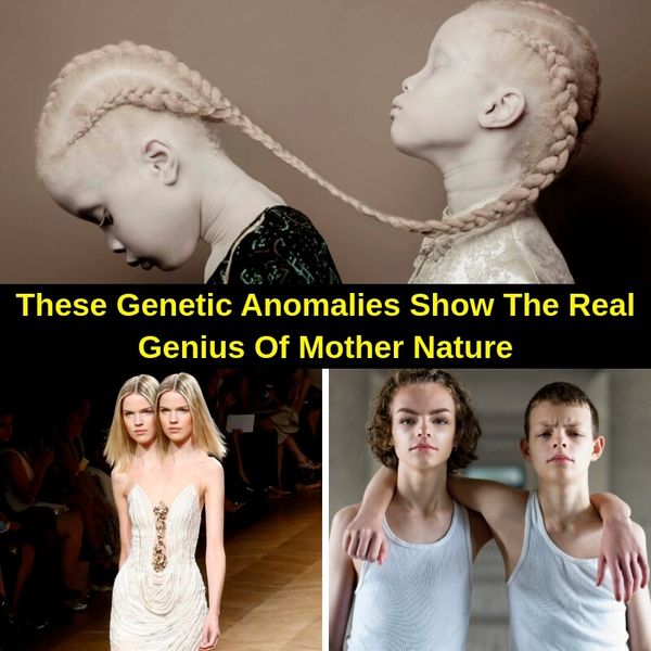 38+ Seriously Unique Features Caused By Genetic Mutations