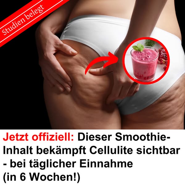 Wissenschaftlich belegt: So kann Cellulite wirklich reduziert werden.