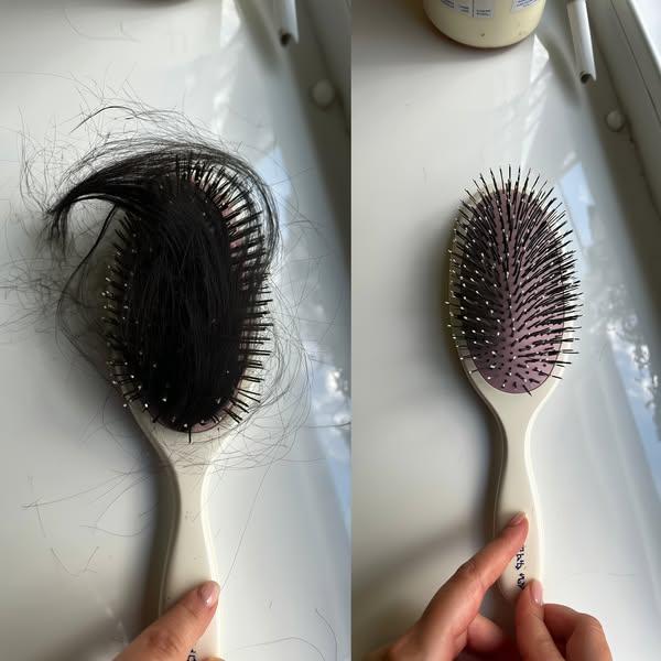 The Real Reason Your Hair Keeps Thinning—No One Talks About This Hormone