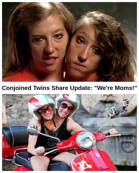 25+ Facts About Abby and Brittany Hensel’s Shared Life