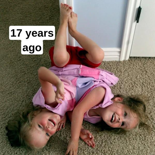 These Formerly Conjoined Twins Are All Grown Up, This Is Them Now