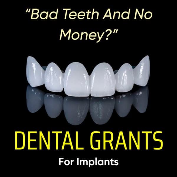 Dental grants are available!