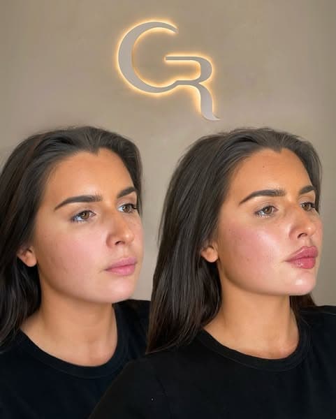 Cosmetic Treatment Consultation