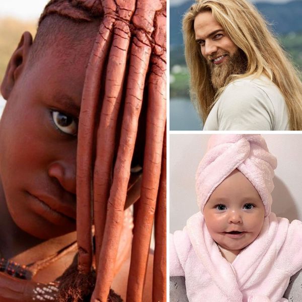 35+ Genetic Mutations That Set These People Apart