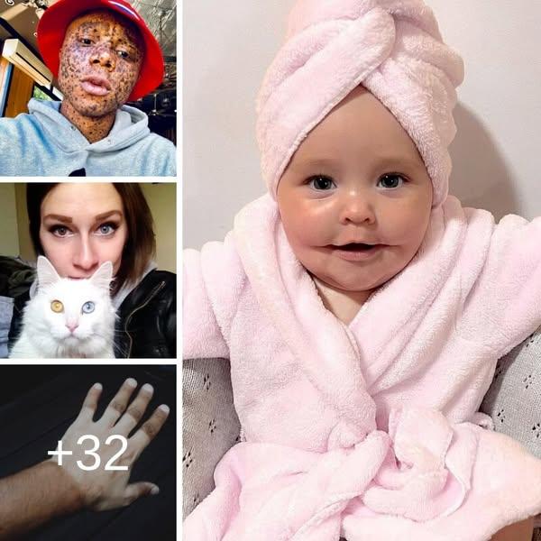 35+ cech genetycznych, które czynią ludzi pięknymi i wyjątkowymi