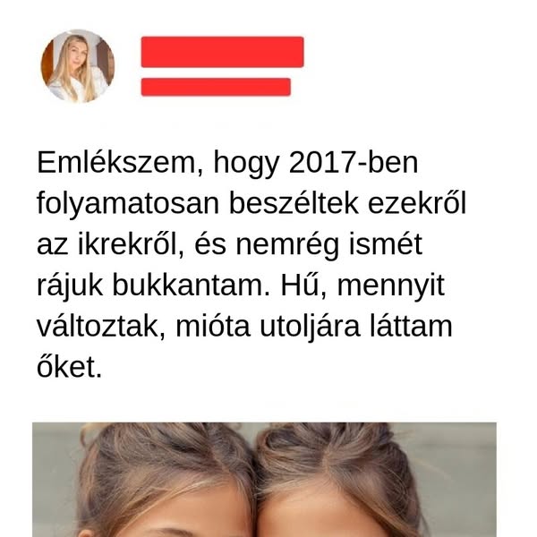 Ezeknek a gyönyörű ikreknek az inspiráló története és a modellkedés útja