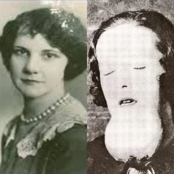 The Story Of The Radium Girls Will Send Goosebumps Down Your Spine