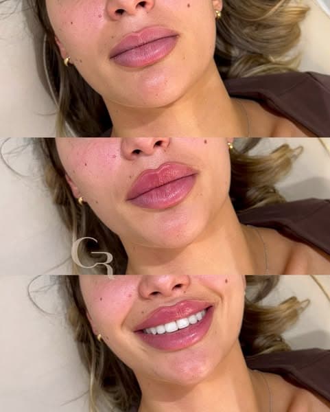 Book A Consultation Today