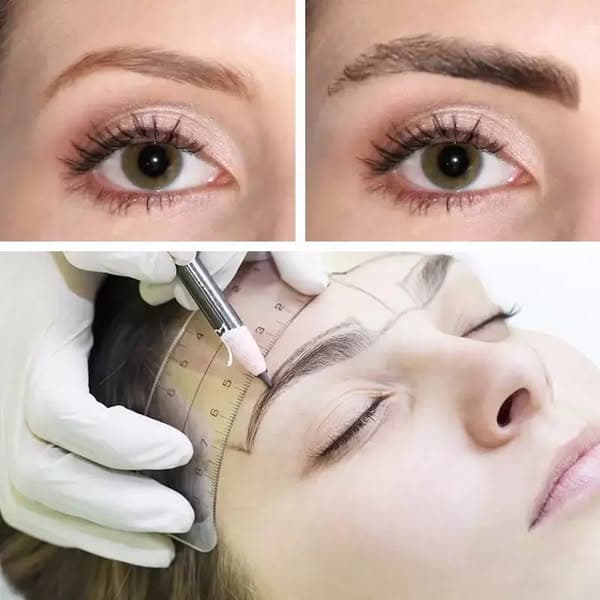 Insights into General Concepts Behind Eyebrow Restoration Procedures
