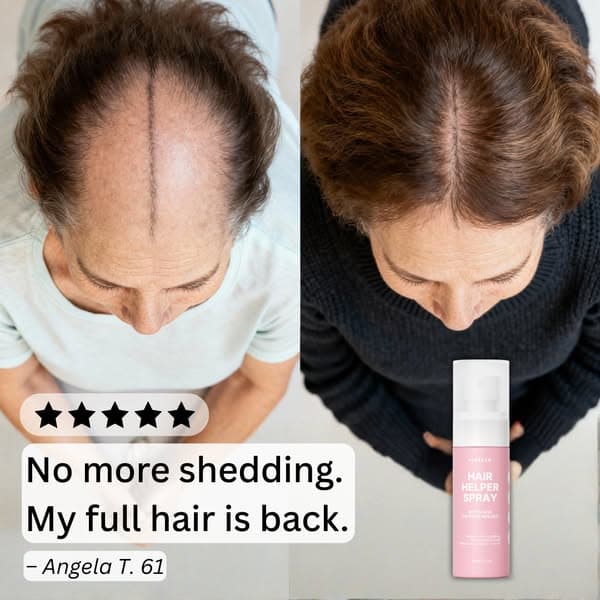 The Real Reason Your Hair Keeps Thinning - No One Talks About This Hormone