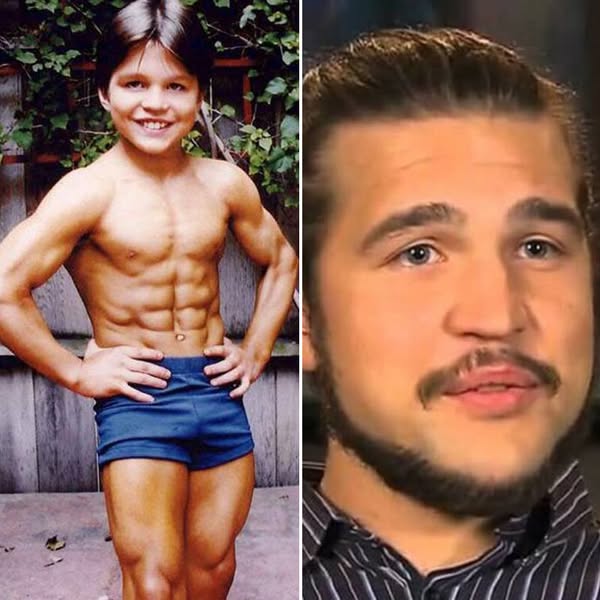 8 Year Old Boy Was Famous For His Giant Muscles, Today He Looks Much Different