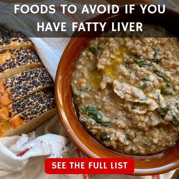 Fatty Liver❓Here Are The Top Foods To Avoid