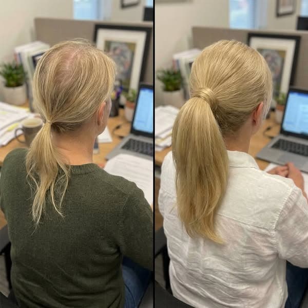 Doc said it's just "aging". She was WRONG!