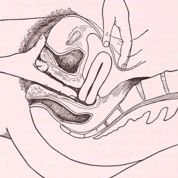 Men Get Medicine Women Get Menopause