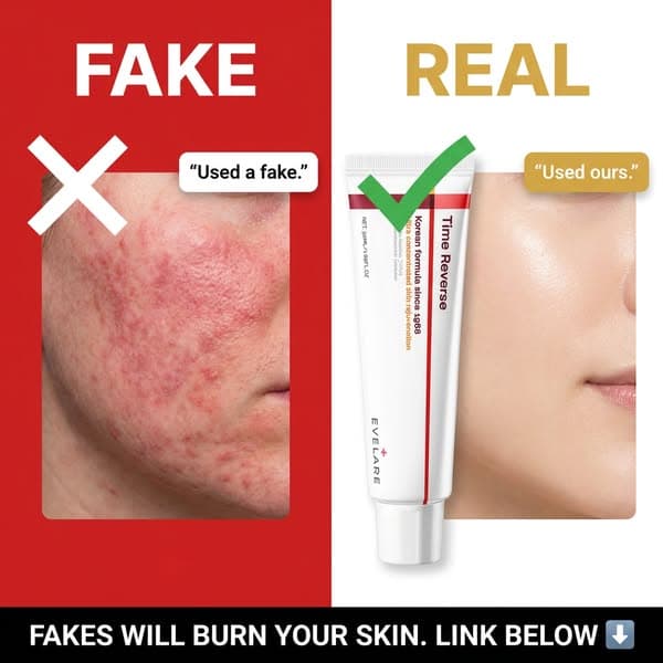 Fakes are everywhere. Get the real one below👇