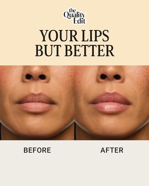 Our Editors' Top Lip Care Pick