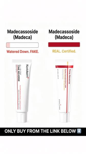 Fakes are everywhere. Get the real one below👇