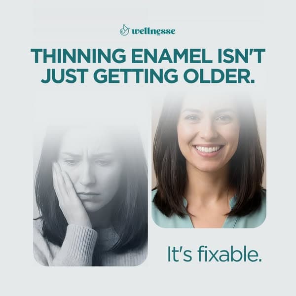 Heal Your Teeth + Save $87