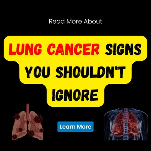 Read More About Lung Cancer Signs You Shouldn’t Ignore