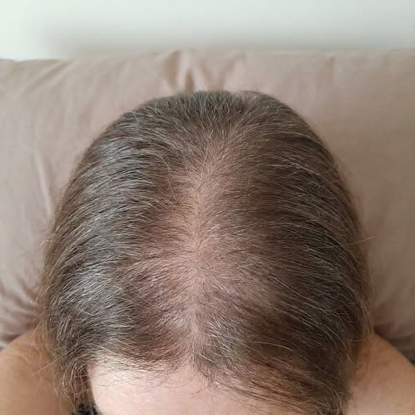 Doc said "it's just menopause", she was WRONG.