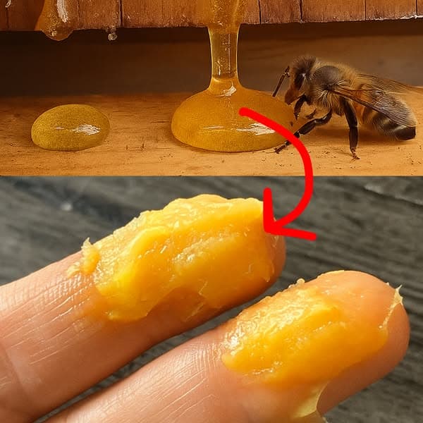 My psoriasis started fading before my eyes!