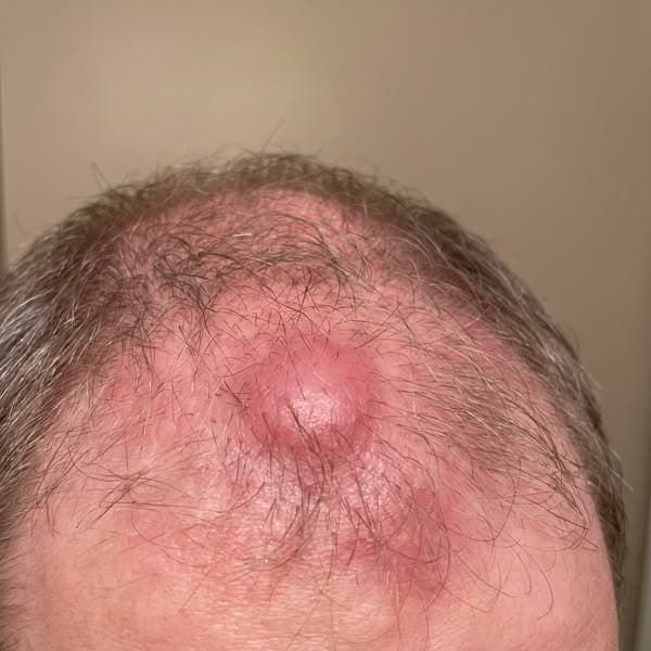 Doc said "it's just menopause." She was WRONG.