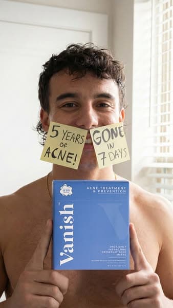 #1 Acne Treatment for Teens (7 Reasons Why)