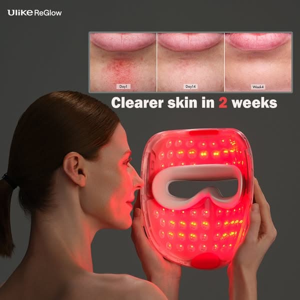 4-in-1 Skin Renewal LED Light Therapy Mask