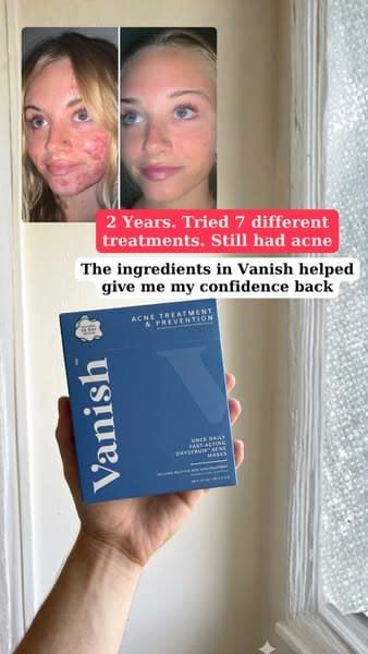 10 Seconds/Day To Clear Skin