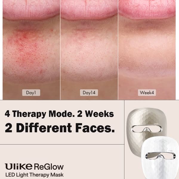 Save $100 Now!