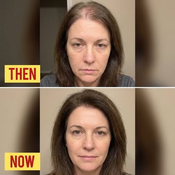 Doc said “it’s just menopause.” She was WRONG.