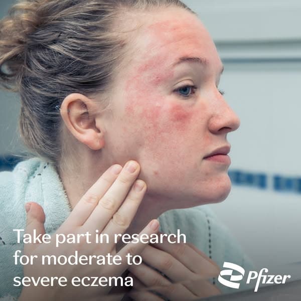 Eczema Research