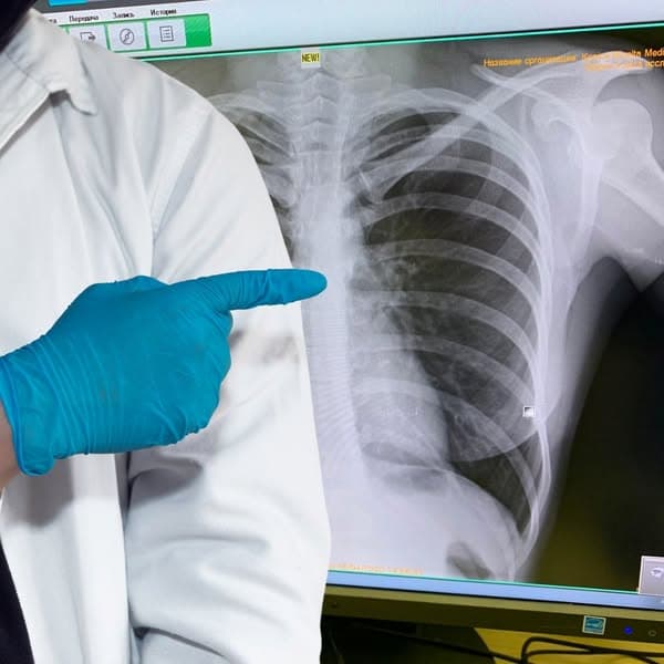 Cumpără-l acum cu 70% reducere 👉