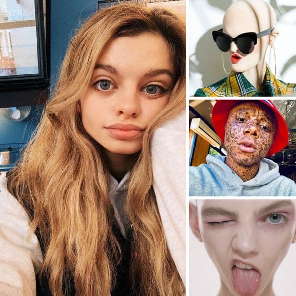 37+ Remarkable Genetic Features Show The Beauty Of Nature