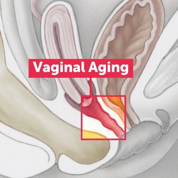 Men Get Medicine Women Get Menopause