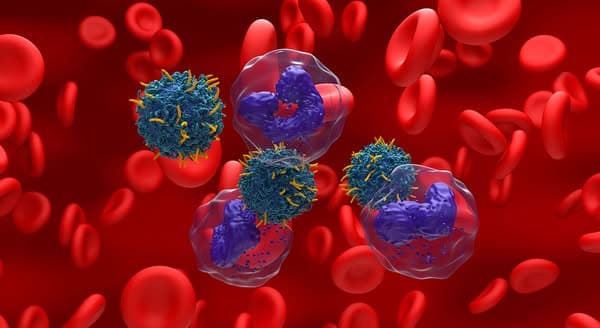AI strengthens oncology data systems