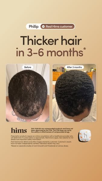 Start My Hair Quiz ✅